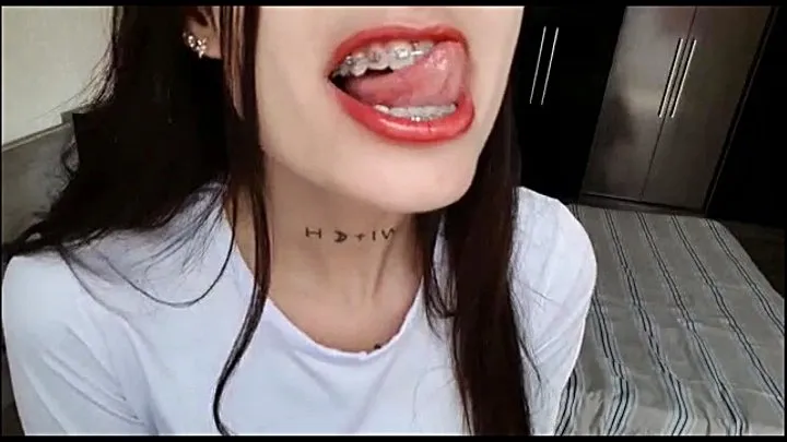 FIRST VIDEO OF MY BRACES