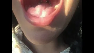 My Uvula 2 Shiny