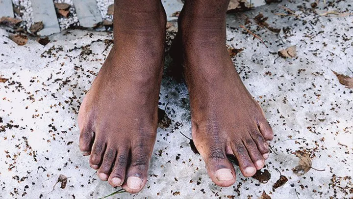 Exclusive series Black on white: Ebony beauty Qween walks barefoot on frozen ground, ice, snow and shows her dirty soles (Part 3 of 6)