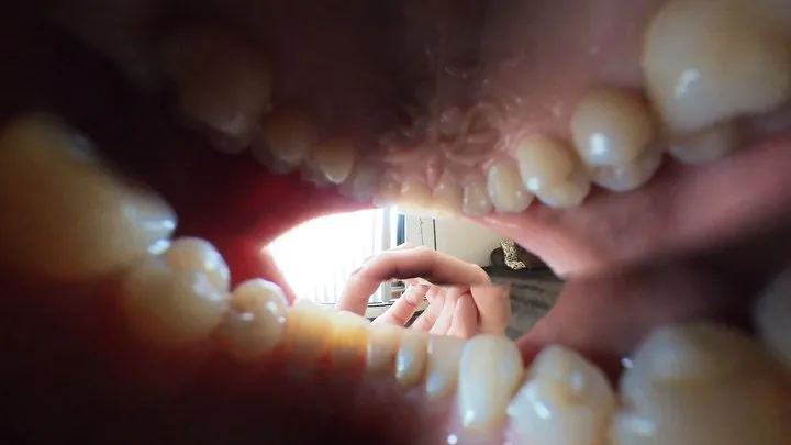 Leijla Giantess Toothache Mouth Vore