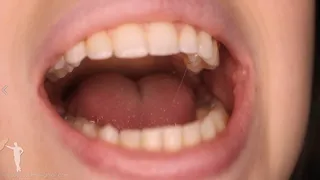 Zaurus Mouth Tongue Teeth Close Up