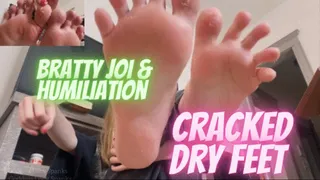 Dirty Dry Feet Humiliating JOI