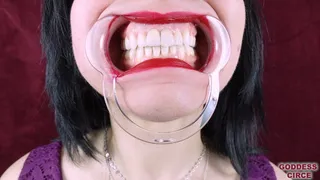 DENTAL MOUTH SPREADER: EXTREME CLOSE-UPS OF MY TEETH AND MOUTH (Video request)