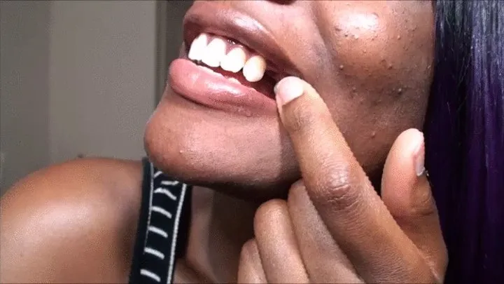 Take a tour of my mouth