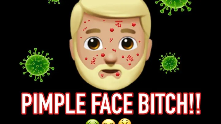 PIMPLE FACE BITCH!!