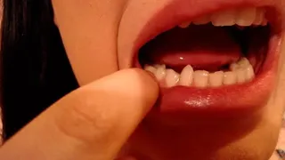 Vampire teeth in action (Custom)