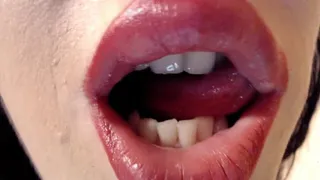 Mouth and teeth provocation