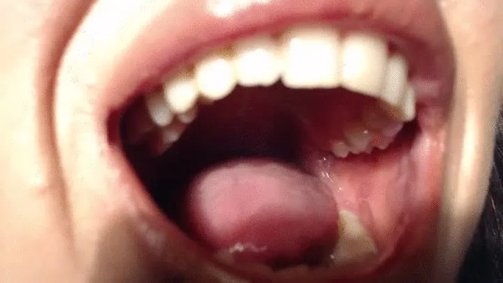 Look at inside of my big mouth