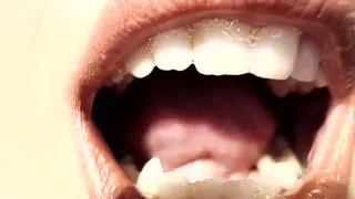 Big mouth full of spit