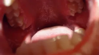 Inside big mouth