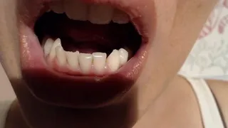 Super sharp ragged teeth - Close up