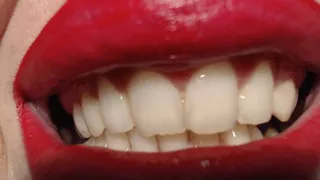 Sharp vampire teeth treatment