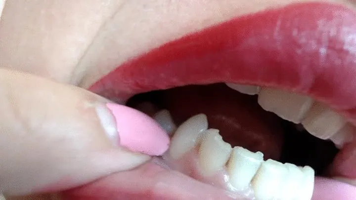 Weird Stasha's teeth