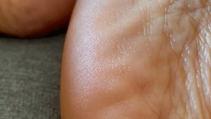 Wrinkled Soles POV 6