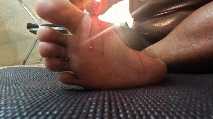 Dripping Hot wax on Soles