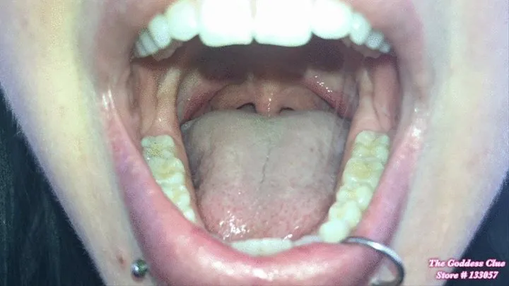 Mouth Opened Wide Part 2