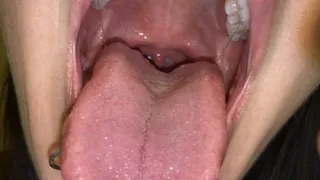 My Pretty Uvula