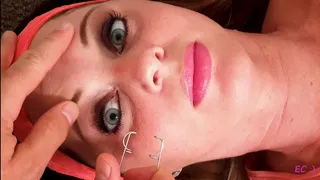 Cum Syringe and Speculum in Eye