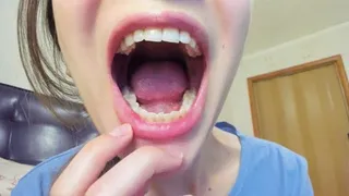 Look inside my mouth!