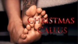 Christmas Callus
