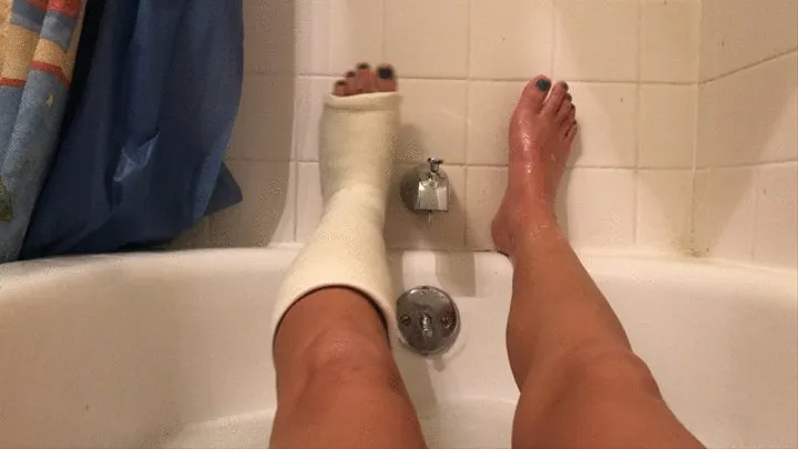 Leg cast and cute feet take bath