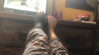 CUTE BLACK CAST ON MY FOOT!