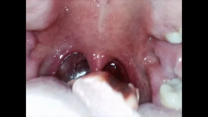 Endoscope open mouth swallow