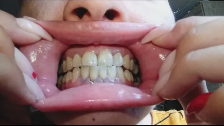 Teeth show off and mouth stretching