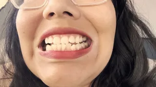 Teeth tour before deep cleaning