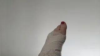 Harlow's bandaged up foot