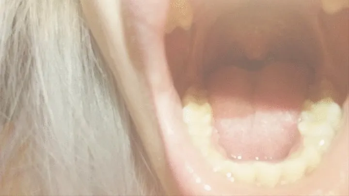 Admire my uvula