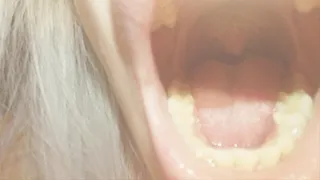 Admire my uvula