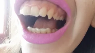 I show you my teeth