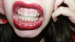 My teeth are chattering -pt 4