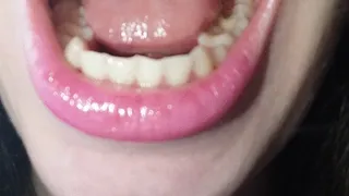 Inside my mouth