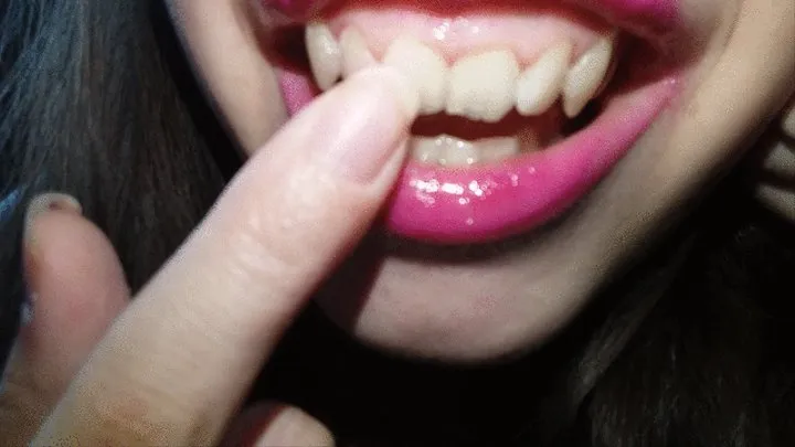 I show you my upper incisors and my canines