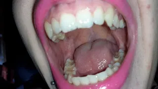 I show you all my stunning teeth