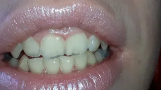 My teeth are chattering - pt6