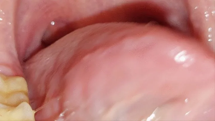 Uvula tour - part 2