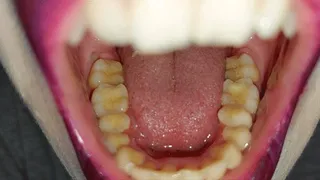 teeth tour - purple lips