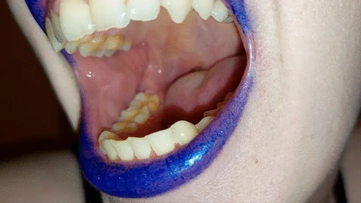 teeth tour - blue lipstick version