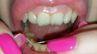 dental floss - part 7