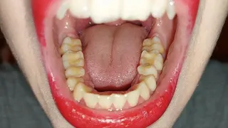 teeth tour - admire my teeth - pt3