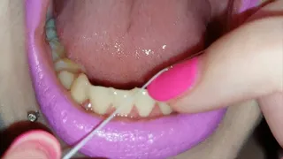 Floss and teeth