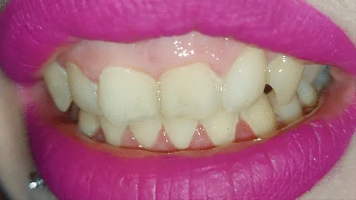 Showing you my teeth - fucsia lipstick