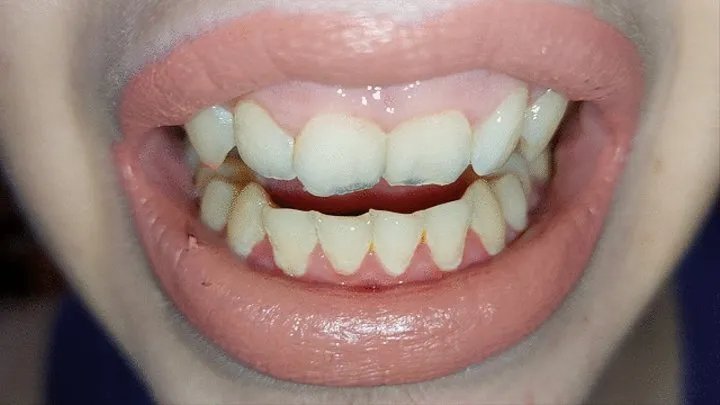 teeth tour - admire my teeth