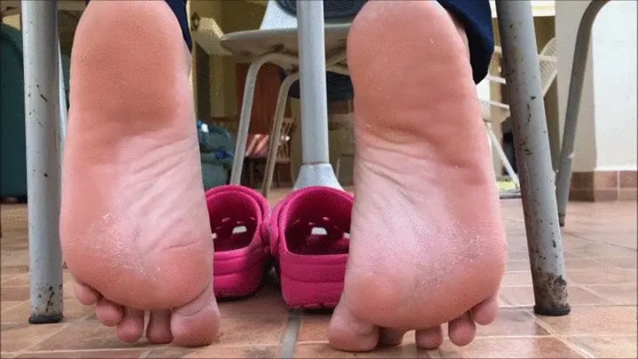 FEET CALLUS ON PINK CROCS