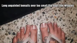 Long Unpainted ToeNails Wiggling Hanging over too small flio flops Flip Foot Fetish Fun