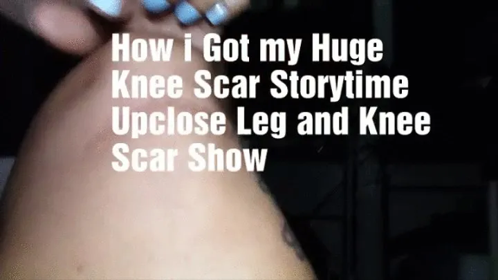 Milf with Tatooed Legs How i got my Huge Knee Scar Storytime and Close up Scars Show