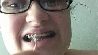 Cleaning my braces